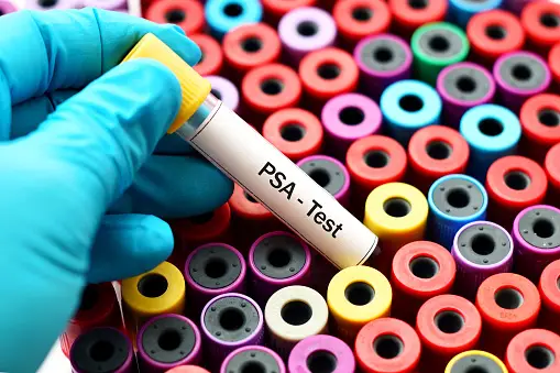 PSA Testing - Another Pharma Boondoggle?